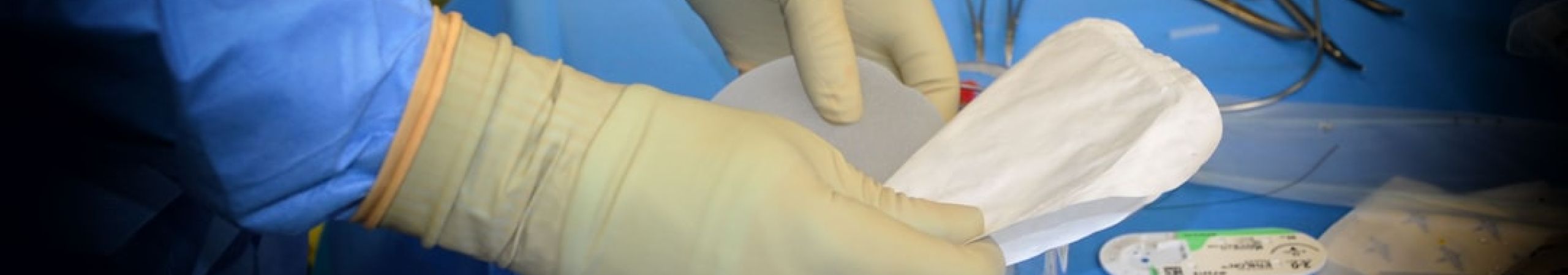 featured 1755820860.569155 Keratin Treatments and Frizz Control